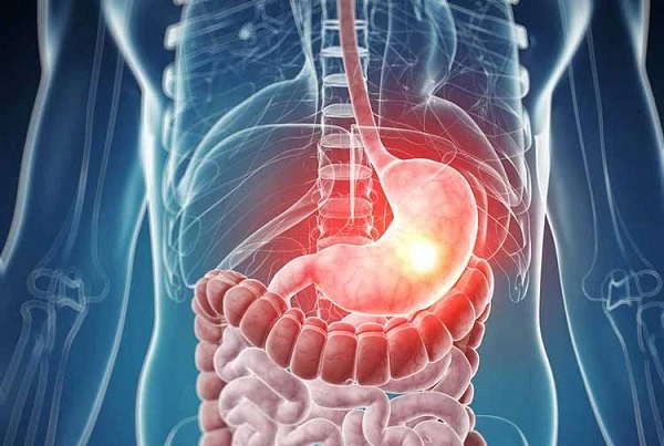 Thực phẩm giúp tẩy sạch hóa chất trong ruột