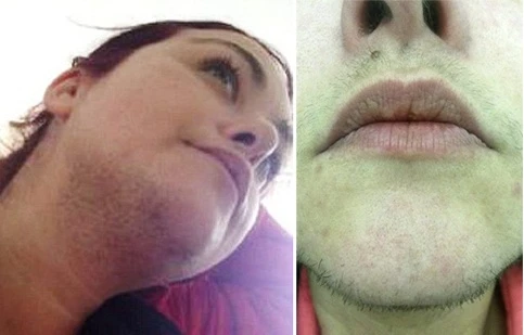 Người phụ nữ kì lạ phải... cạo râu 3 lần/ngày