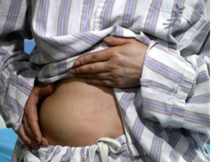 Kinh hoàng miếng độn ngực "đi lạc" xuống bụng