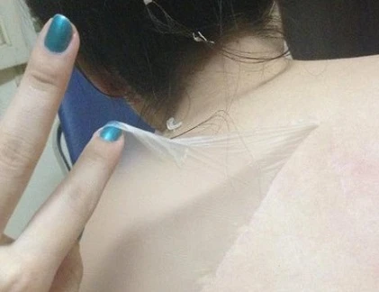 Top xu hướng làm trắng da mới nổi cực nguy hiểm