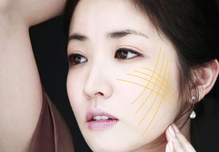 Những phương pháp làm đẹp không phẫu thuật