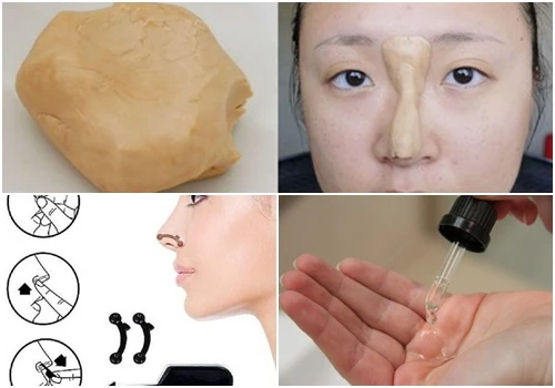 Những kiểu nâng mũi tạm thời gây choáng váng