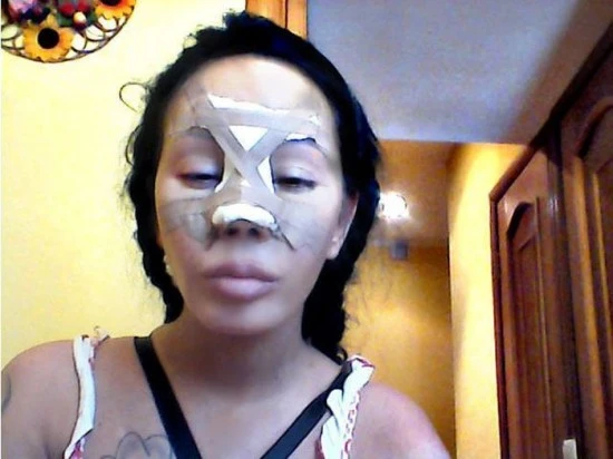 Hành trình “dao kéo” thành quái vật của ca sĩ Nga