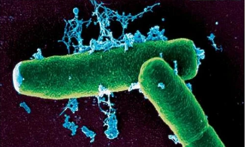 Rùng mình xem vi khuẩn bệnh Than tấn công cơ thể người