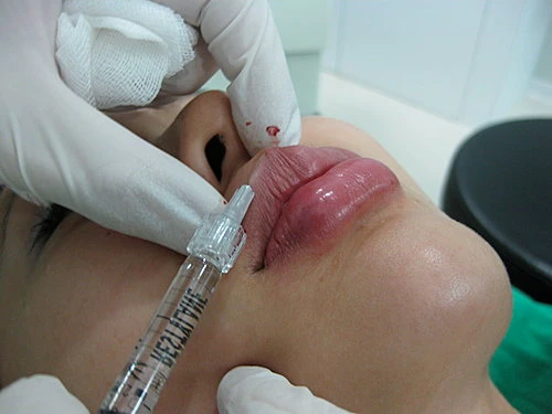 Hành trình 30 lần “dao kéo” của nữ MC Trung Quốc