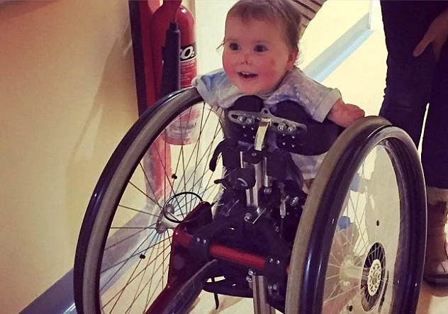 Rơi lệ xem em bé không tay chân vật lộn với cuộc sống