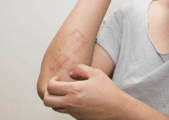 Hai bộ phận trên cơ thể bị “ngứa ngáy”, đừng lầm tưởng là dị ứng - Hình 2 Hai bo phan tren co the bi “ngua ngay”, dung lam tuong la di ung-Hinh-2