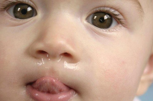 Những sai lầm của cha mẹ khi trẻ chảy nước mũi - Hình 2 Nhung sai lam cua cha me khi tre chay nuoc mui-Hinh-2
