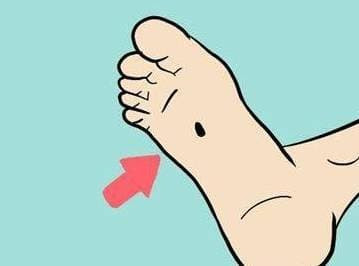 Phụ nữ mọc nốt ruồi ở đâu tốt? - Hình 5 Phu nu moc not ruoi o dau tot?-Hinh-5