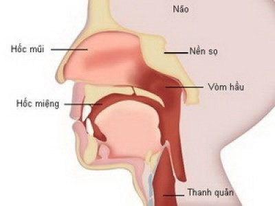 4. Ung thư mũi, xoang cạnh mũi. Ung thư có thể phát triển trong da của lỗ mũi và niêm mạc mũi.