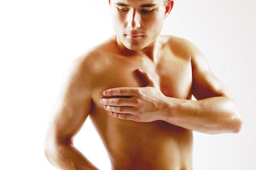 4. Một trong những loại hiếm của ung thư vú là ung thư vú nam. Ung thư này lây lan qua hệ bạch huyết và mạch máu ở nam giới, giống như ung thư vú nữ. Các tổn thương ở nam giới dễ dàng phát hiện hơn do kích thước vú nhỏ. Tuy nhiên, hầu hết các trường hợp ung thư vú của nam giới được chẩn đoán ở giai đoạn III hoặc IV.