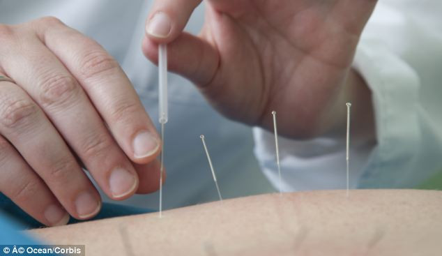 Người phụ nữ được điều trị bằng thuốc giảm đau và chống viêm nhưng không có tác dụng, khiến dạ dày có cảm giác khó chịu. Vì thế, cô quay sang phương pháp châm cứu ít nhất một lần một tuần.