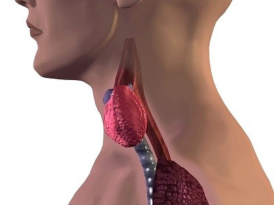 2. Ung thư nang xảy ra ở khu vực triiodothyronine trong những phụ nữ thuộc nhóm tuổi 50 trở lên. Các khối u nang có một lớp mô mỏng xung quanh, được gọi là viên nang.