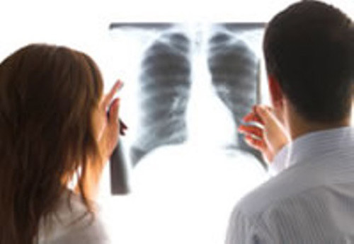 CT liều thấp là những thử nghiệm được dùng để giảm tử vong do ung thư phổi ở người hút thuốc có nguy cơ cao. Việc chẩn đoán, điều trị trở nên dễ dàng và chính xác hơn cho các bác sĩ.