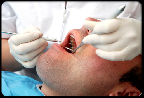 Nếu bạn hút thuốc, bạn cần phải đặc biệt cảnh giác với bất kỳ mảng trắng trong miệng hoặc đốm trắng trên lưỡi. Những thay đổi này có thể là leukoplakia, dấu hiệu của tiền ung thư có thể xảy ra khi kích thích liên tục và trở thành ung thư miệng.