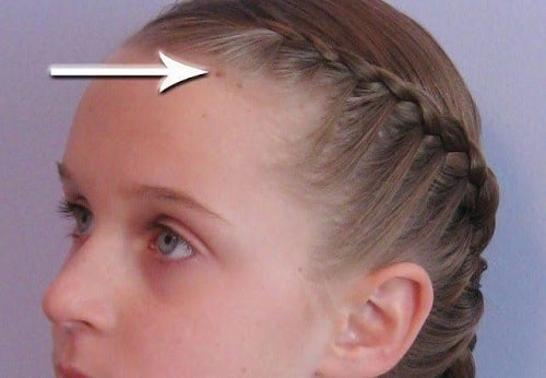 Nốt ruồi ở chân tóc: Phúc khí suôn sẻ. Nốt ruồi ở chân tóc nói chung là ẩn trong tóc nên nếu không quan sát kỹ sẽ khó phát hiện ra nên được gọi là nốt ruồi ẩn. Nốt ruồi ẩn dưới chân tóc biểu thị sự giàu có, càng ẩn sâu thì người đó càng giàu có.