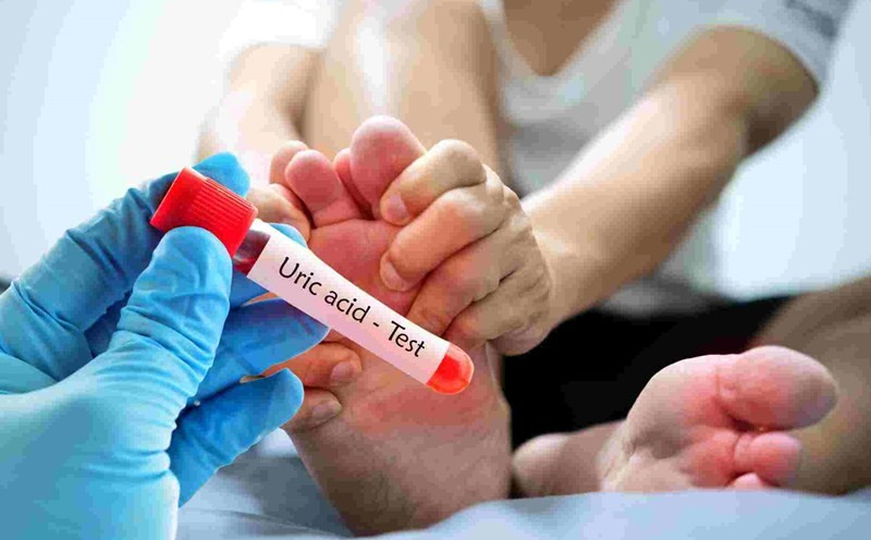 Các chuyên gia khuyến cáo, đồ uống chỉ đóng vai trò hỗ trợ. Người có axit uric tăng cao cần kết hợp chế độ ăn ít purine, duy trì vận động phù hợp và tuân thủ hướng dẫn điều trị của bác sĩ. Việc lựa chọn đúng đồ uống trong mùa lạnh không chỉ giúp giảm nguy cơ gout tái phát mà còn góp phần bảo vệ sức khỏe tổng thể trong suốt mùa đông. Ảnh minh họa