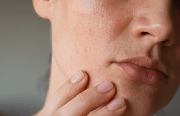 Thời tiết lạnh, hanh khô khiến làn da dễ mất nước, bong tróc nếu chăm sóc không đúng cách. Nhiều thói quen tưởng chừng vô hại lại vô tình làm suy yếu hàng rào bảo vệ da, khiến da ngày càng khô nẻ và nhạy cảm. Ảnh minh họa