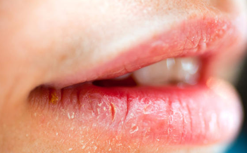 Mùa đông đến, làn môi dễ khô nứt, bong tróc, khiến nhiều người cảm thấy thiếu tự tin. Ngoài việc dưỡng ẩm, tẩy tế bào chết định kỳ là bước quan trọng giúp loại bỏ lớp da chết, phục hồi sự mềm mại và hồng hào cho đôi môi. Dưới đây là 4 công thức đơn giản, dễ thực hiện ngay tại nhà. Ảnh minh họa