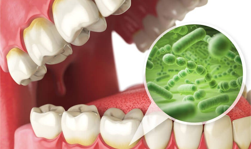 Các chuyên gia nha khoa cảnh báo rằng, vào buổi sáng, hoạt động tiết nước bọt trong miệng còn yếu. Nước bọt đóng vai trò trung hòa axit, làm sạch khoang miệng và bảo vệ răng khỏi vi khuẩn. Khi lượng nước bọt giảm, răng dễ bị tấn công bởi axit từ thức ăn hoặc đồ uống, dẫn đến men răng bị ăn mòn, ê buốt và tăng nguy cơ sâu răng. Ảnh minh họa