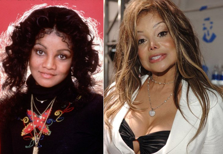 La Toya Jackson là minh chứng hùng hồn, phẫu thuật thẩm mỹ sẽ phá hủy vẻ đẹp cơ thể đặc biệt khi bạn già đi. Hình ảnh tươi tắn tự nhiên khi còn là một thành viên nhóm nhạc anh em nhà Jackson đã được La Toya thay thế bởi khuôn mặt được đập đi làm lại hoàn toàn. Qua năm tháng, càng có tuổi, “mặt tiền” của La Toya càng xập xệ thấy rõ.