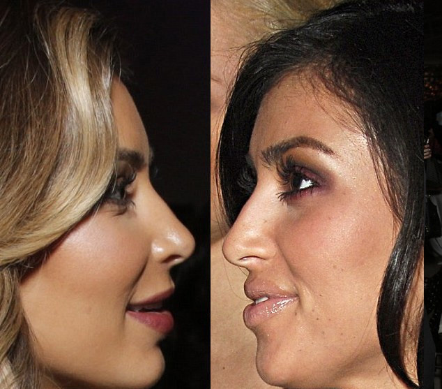 Kim Kardashian chưa bao giờ thừa nhận chuyện làm mũi, nhưng khi so sánh hình ảnh trước kia và bây giờ của cô, rõ ràng, ngôi sao "Keeping Up With The Kardashian" đã động dao kéo tới bộ phận này.