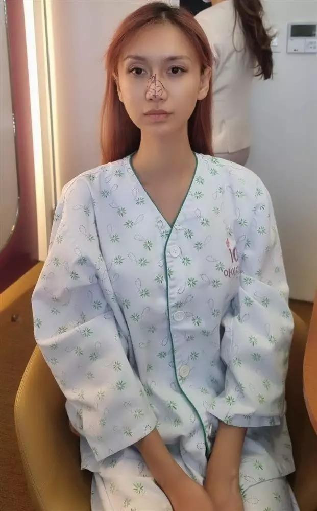 Trước đó, nữ ca sĩ Tạm Biệt Nhé gây xôn xao khi công khai loạt ảnh sang Hàn can thiệp phẫu thuật thẩm mỹ lần nữa. Hậu chuyển giới, Lynk Lee sở hữu nhan sắc xinh đẹp cùng những đường nét hài hòa. Riêng phần sống mũi vốn cao từ khi chưa chuyển giới nhưng lại có khuyết điểm đầu mũi to, vậy nên có lẽ cô muốn sửa lại cho mềm mại và thanh thoát hơn.