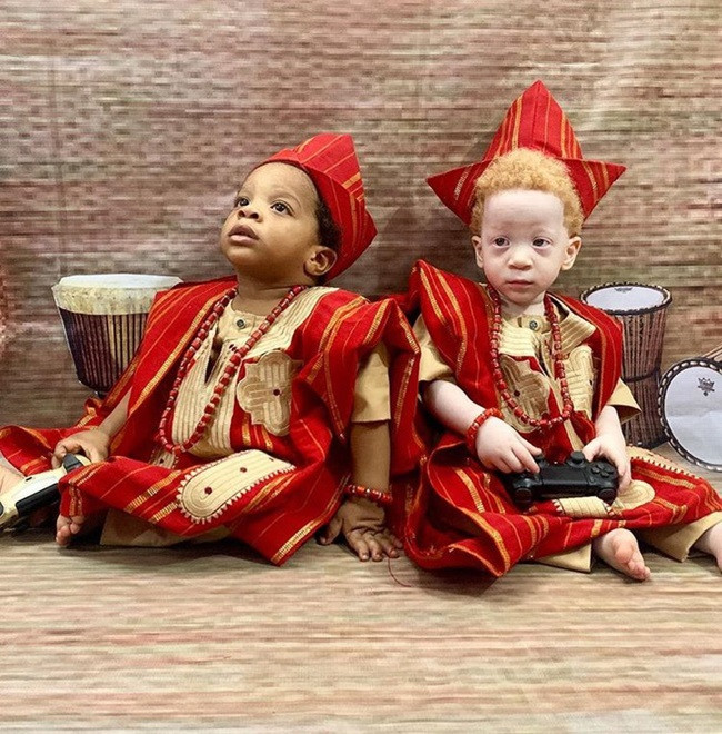 Hai bé sinh đôi có nét mặt và các đặc điểm khuôn mặt giống nhau nhưng lại khác ở màu da và máu tóc. Daniel chào đời trước David vài phút. Bé có màu da đen, tóc đen và xoăn y hệt như bố mẹ và chị gái 4 tuổi. Trong khi đó, David lại có da trắng, tóc vàng.
