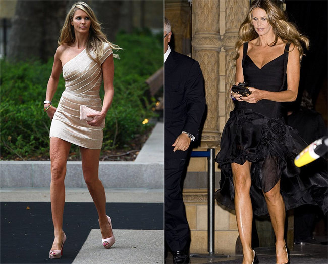 Siêu mẫu một thời Elle Macpherson cũng bị thời gian tàn phá tới mức đôi chân của cô nhăn nheo từ trên xuống dưới.