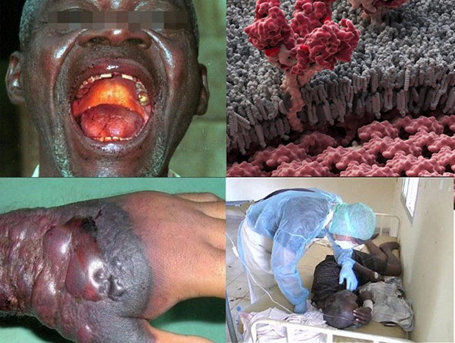 Sau đó, virus Ebola đã nhanh chóng lan ra cộng đồng của ngôi làng nhỏ này và giết chết hàng trăm người dân địa phương.