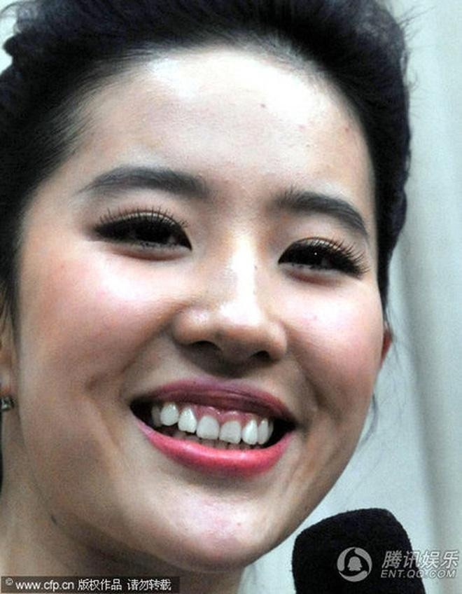 Hàm răng khấp khểnh, hở cả lợi khi cười trở thành khuyết điểm "chí mạng" của mỹ nhân Hoa ngữ này.