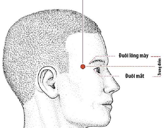 Huyệt Thái Dương thấp lõm. Huyệt Thái Dương chính là vị trí cung Phu Thê, nằm cạnh 2 đuôi mắt. Huyệt Thái Dương đầy đặn thì tài phúc vẹn toàn, cuộc sống giàu có cả về vật chất và tinh thần. Huyệt Thái Dương thấp lõm thì công danh sự nghiệp trắc trở, thiếu may mắn trong cuộc sống, tài lộc đến rồi lại đi, khó tụ.