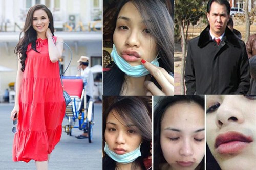 Chưa dừng lại ở đó, Diễm Hương tung một loạt bằng chứng bị chồng cũ lừa gạt, đe dọa, hành hung với những hình ảnh mặt mày thâm tím. Theo lời người đẹp, chồng cũ đã mang lại cho cô cuộc sống dư dả vật chất, "thừa tiền tỷ nhưng thiếu tự do". Chính điều đó buộc lòng cô phải rời xa anh. Trong khi đó, chồng Diễm Hương cũng bức xúc tố ngược lại vợ lăng nhăng, không quan tâm đến gia đình.