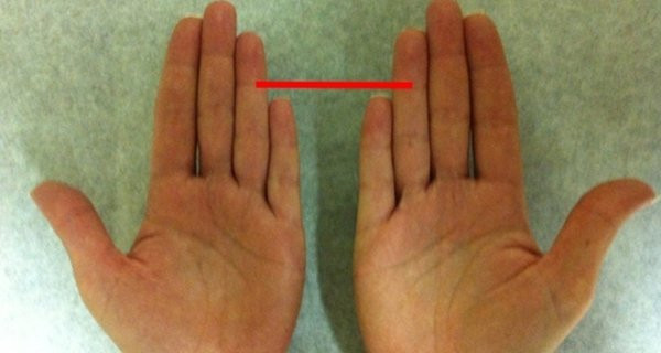Chênh lệch về độ dài giữa ngón tay đeo nhẫn và ngón trỏ càng lớn thì hàm lượng testosterone của bạn càng nhiều. Ngược lại, người có ngón áp út ngắn hơn ngón trỏ sẽ có nhiều estrogene và ít testosterone hơn (tức là nữ tính hơn).