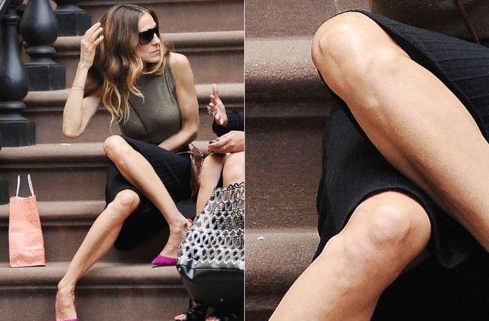 Hai đầu gối của Sarah Jessica Parker chỉ toàn da và xương.
