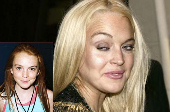 Từ một ngôi sao nhí đáng yêu, hình ảnh của Lindsay Lohan ngày càng xuống cấp khi cô dính vào ma túy. Hàng loạt những hệ lụy xảy ra sau đó như vào tù, cai nghiện, không một xu dính túi cũng từ ma túy mà ra.