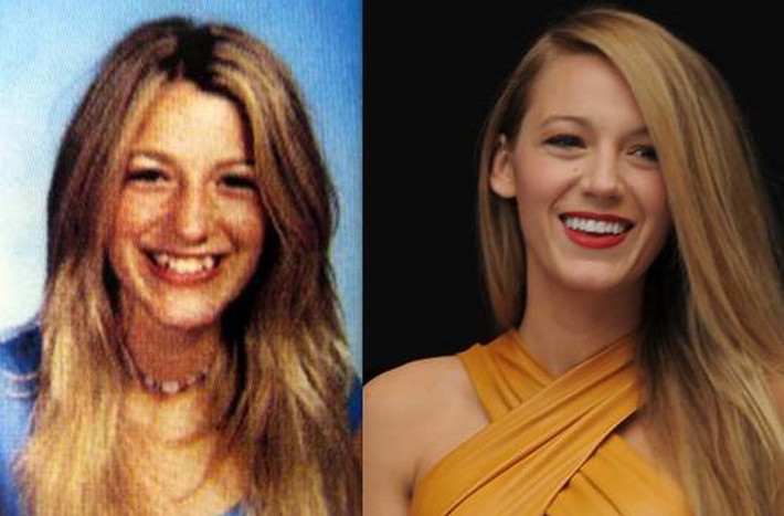 Khi chưa nổi tiếng, nhan sắc của Blake Lively chỉ xếp ở hạng trung bình vì hàm răng khểnh xấu xí. Hình ảnh của cô hiện tại từ nét mặt cho tới mái tóc, thân hình, đều không còn có điểm gì để chê nữa.
