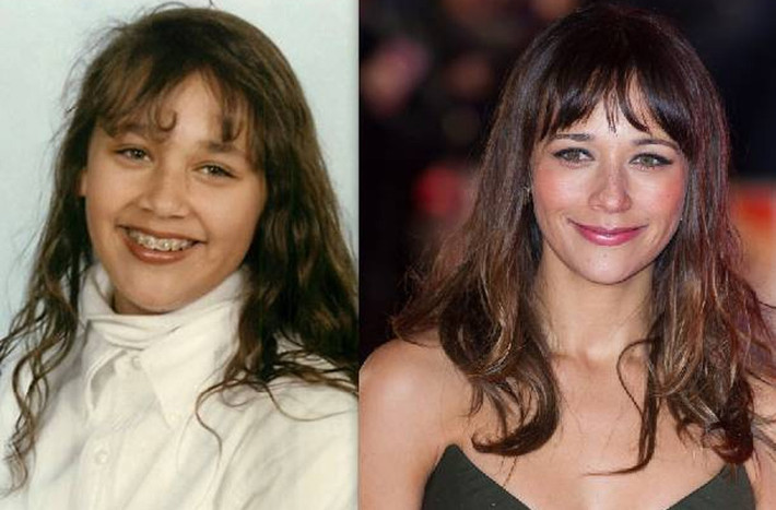 Nét mặt của nữ diễn viên Rashida Jones hiện tại so với lúc nhỏ thay đổi khá nhiều nhờ hàm răng đã được niềng cẩn thận.