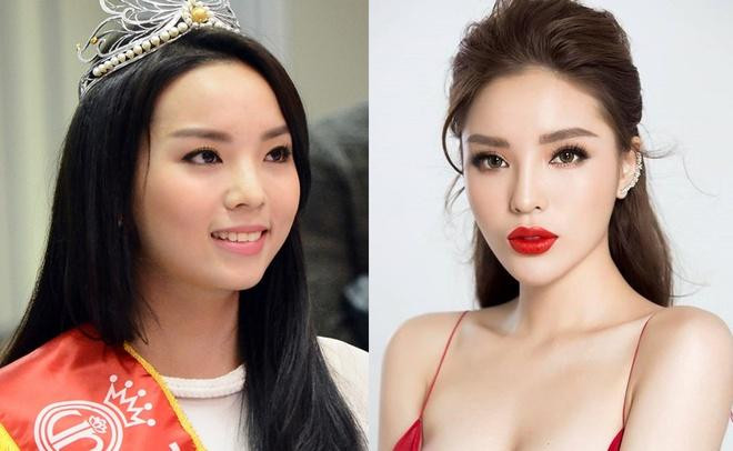 Kỳ Duyên - Hoa hậu Việt Nam 2014 - cũng từng vướng nhiều nghi vấn phẫu thuật thẩm mỹ, khi gương mặt lạ hoắc so với thời điểm đăng quang.