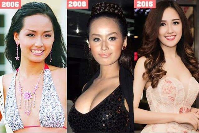 Hoa hậu Việt Nam 2006 - Mai Phương Thúy - là cái tên thường xuyên gắn với những nghi vấn phẫu thuật thẩm mỹ. Cô thay đổi chóng mặt theo thời gian, gương mặt lên hương, vòng 1 cũng "đô" thấy rõ.