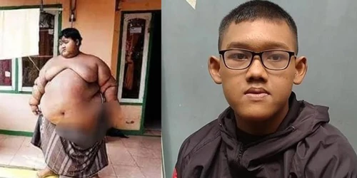 Giảm cân ngoạn mục, bé trai nặng nhất thế giới “đốn tim” người nhìn