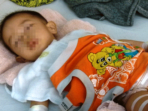 Hy huu nhung ca chan doan benh nham cua bac si Viet Nam-Hinh-4