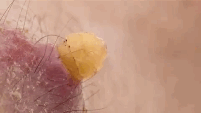 Noi da ga xem au trung ruoi chui ra tu da nguoi