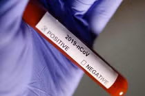 Khẩn: Toàn quốc “nói không” với xét nghiệm COVID-19 dịch vụ theo yêu cầu