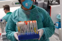 Chấn động: Chính phủ Anh đặt hàng kit xét nghiệm COVID-19 có dính virus corona 