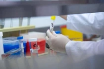 Người nước ngoài bị tai nạn ở Hà Nội dương tính COVID-19 là trường hợp rất nguy hiểm