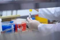 Người nước ngoài bị tai nạn ở Hà Nội dương tính COVID-19 là trường hợp rất nguy hiểm