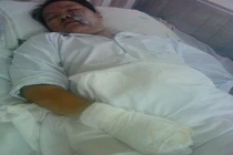 Bị phụ tình, phóng hỏa thiêu người yêu