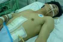 Gã si tình gây án mạng chấn động KCN