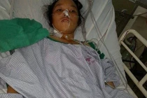 Kinh hoàng 40 con giun làm tổ trong ống mật chủ